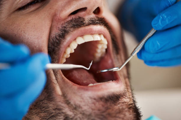 Best Mobile Emergency Dentist in La Honda, CA